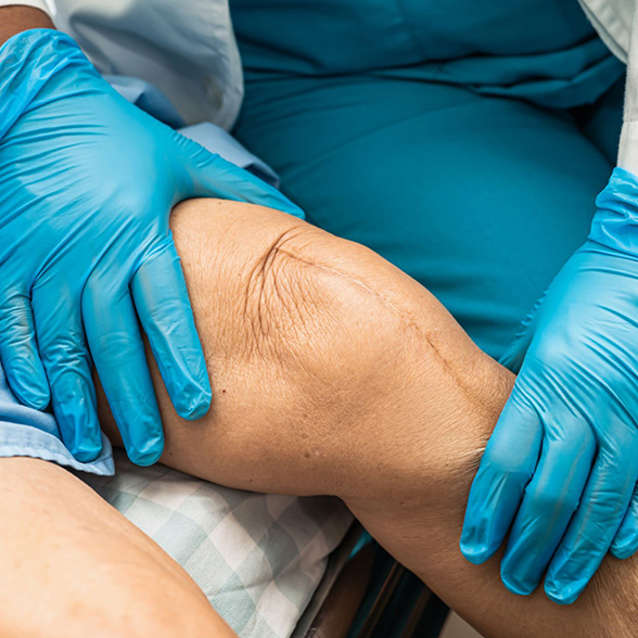 Non Operative Musculoskeletal img