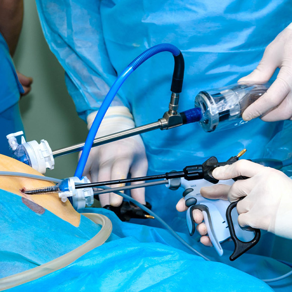 Arthroscopy img