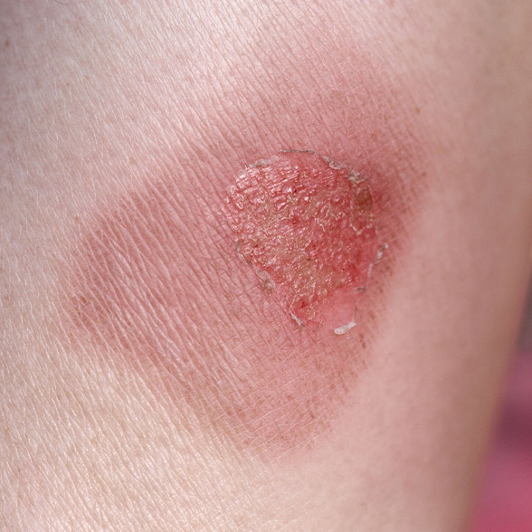 Skin-Aesthetic-Conditions